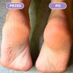 Amirio - Szklany Pilnik do stóp